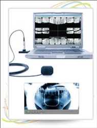 글로벌 치과용 디지털 엑스레이 시장 성장