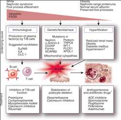 글로벌 국소 분절 사구체 경화증(FSGS) 치료 시장 통찰력