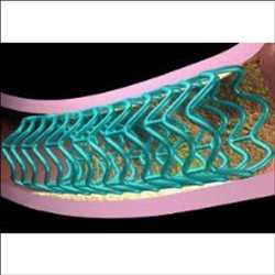 생체흡수성 스텐트 시장
