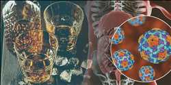 글로벌 알코올성 간염 치료제 미래 시장 범위