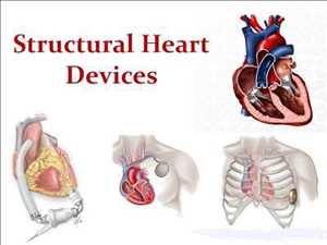글로벌구조용 심장 장치 시장 미래 범위