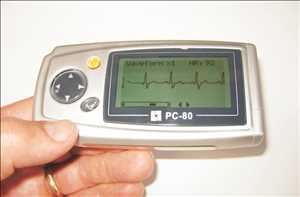 글로벌단일 리드 ECG 장비 시장 공급업체 현황