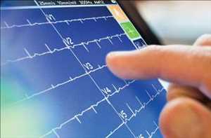 글로벌 진단 ECG 시장 현황