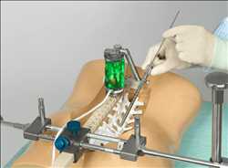 글로벌척추 수술 로봇 시장 미래 데이터