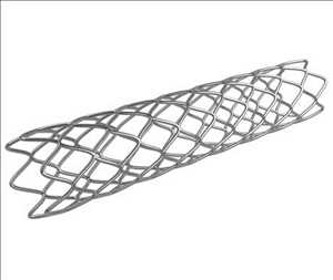 글로벌 혈관 스텐트 시장 점유율